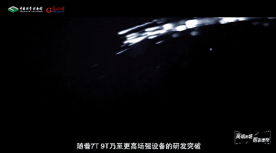【智造未来】高磁建场 医影革新——超高场全身临床成像技术
