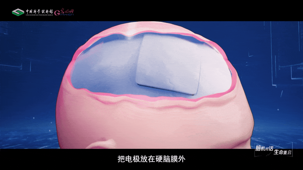 【智造未来】脑机对话 生命重启——“北脑一号”智能脑机系统