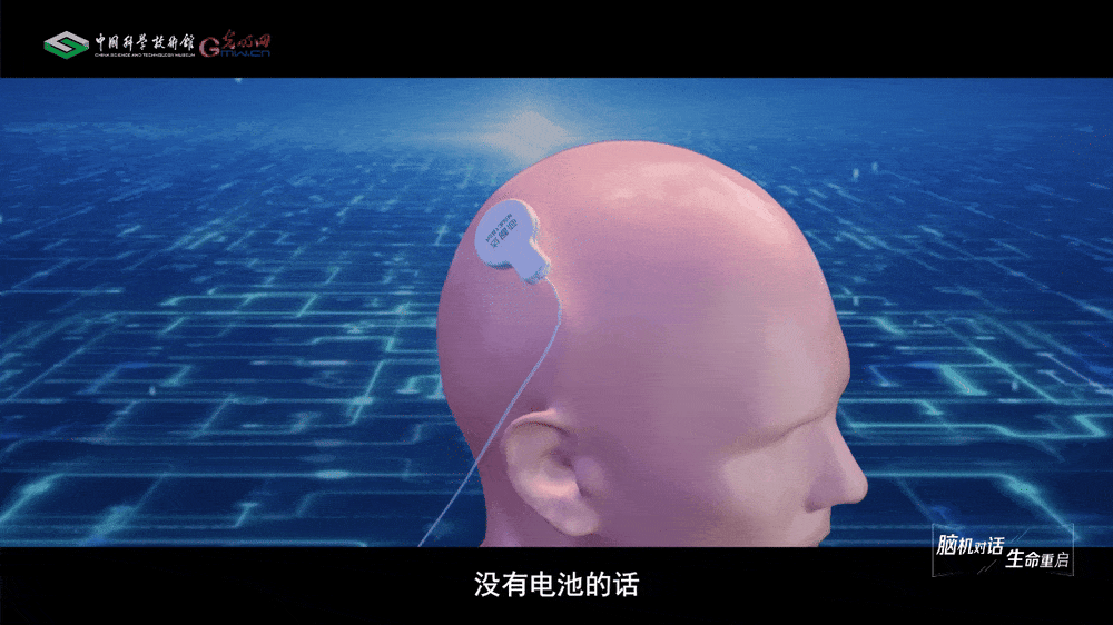 【智造未来】脑机对话 生命重启——“北脑一号”智能脑机系统