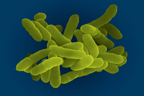 科学家警惕可抵抗所有抗生素的细菌感染