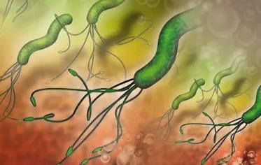 幽门螺杆菌能致癌？真的假的？！