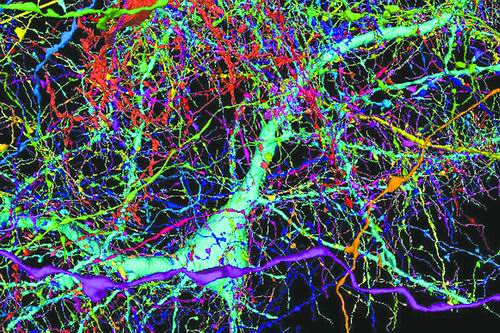 最详细的人脑内部连接图发布 展示了人脑神经元间的连接模式