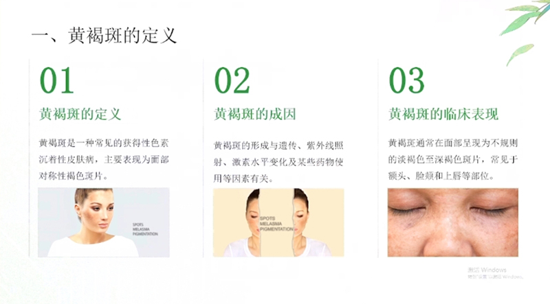 科普慕课｜黄褐斑防治，中医内外调理有妙招
