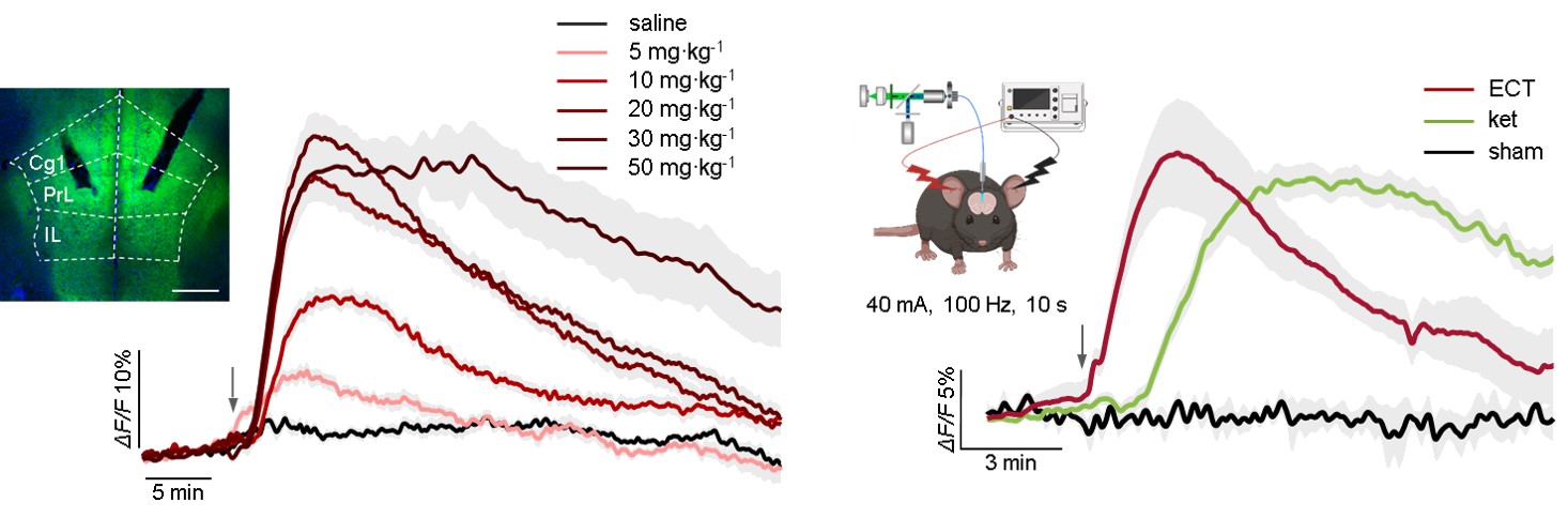 《自然》杂志：氯胺酮抗抑郁之谜，被“腺苷”破解了