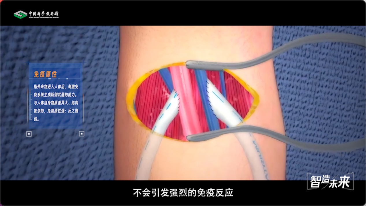 【智造未来】血液通道 生命桥梁——人造血管研发技术