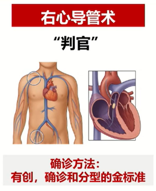 科普慕课｜患肺动脉高压，身体会出现哪些症状？