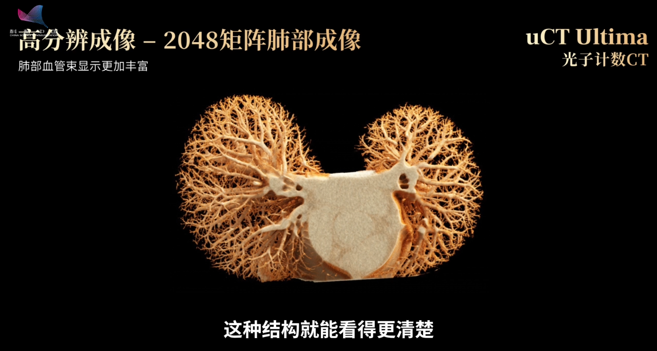 做一次CT有多少辐射？一根香蕉告诉你答案